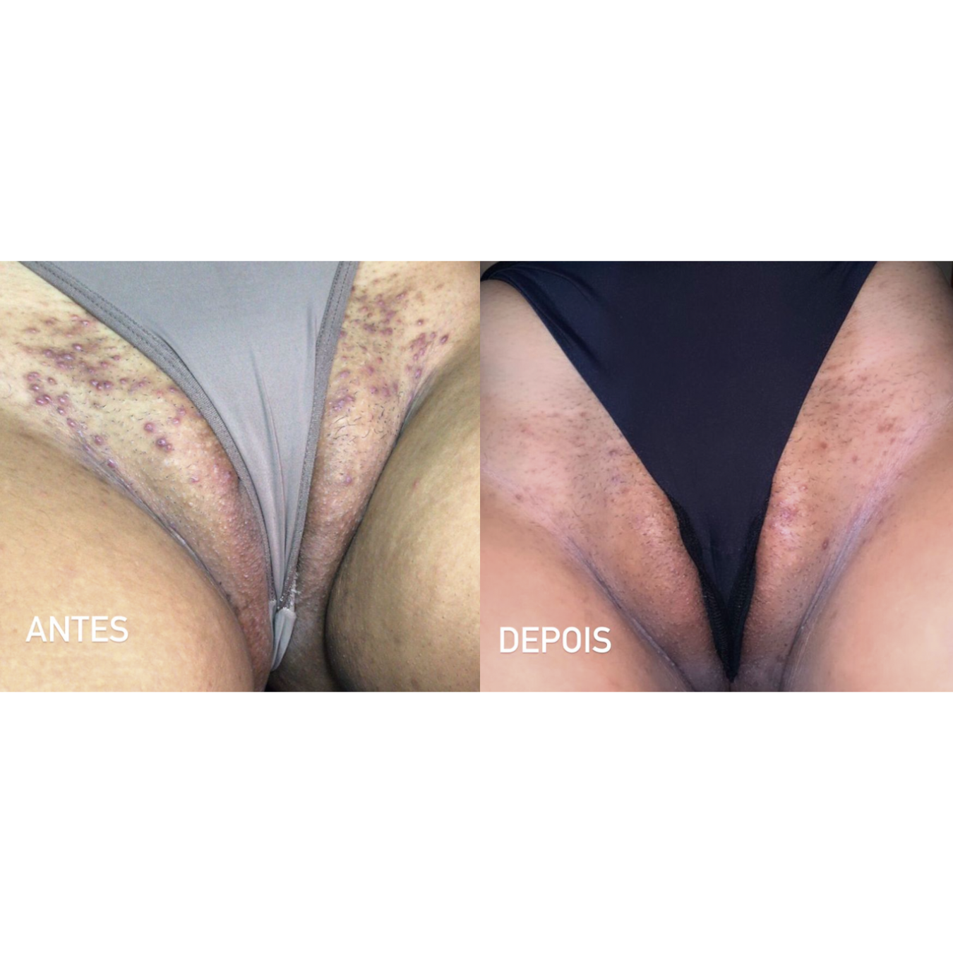 Resultado clínico 2