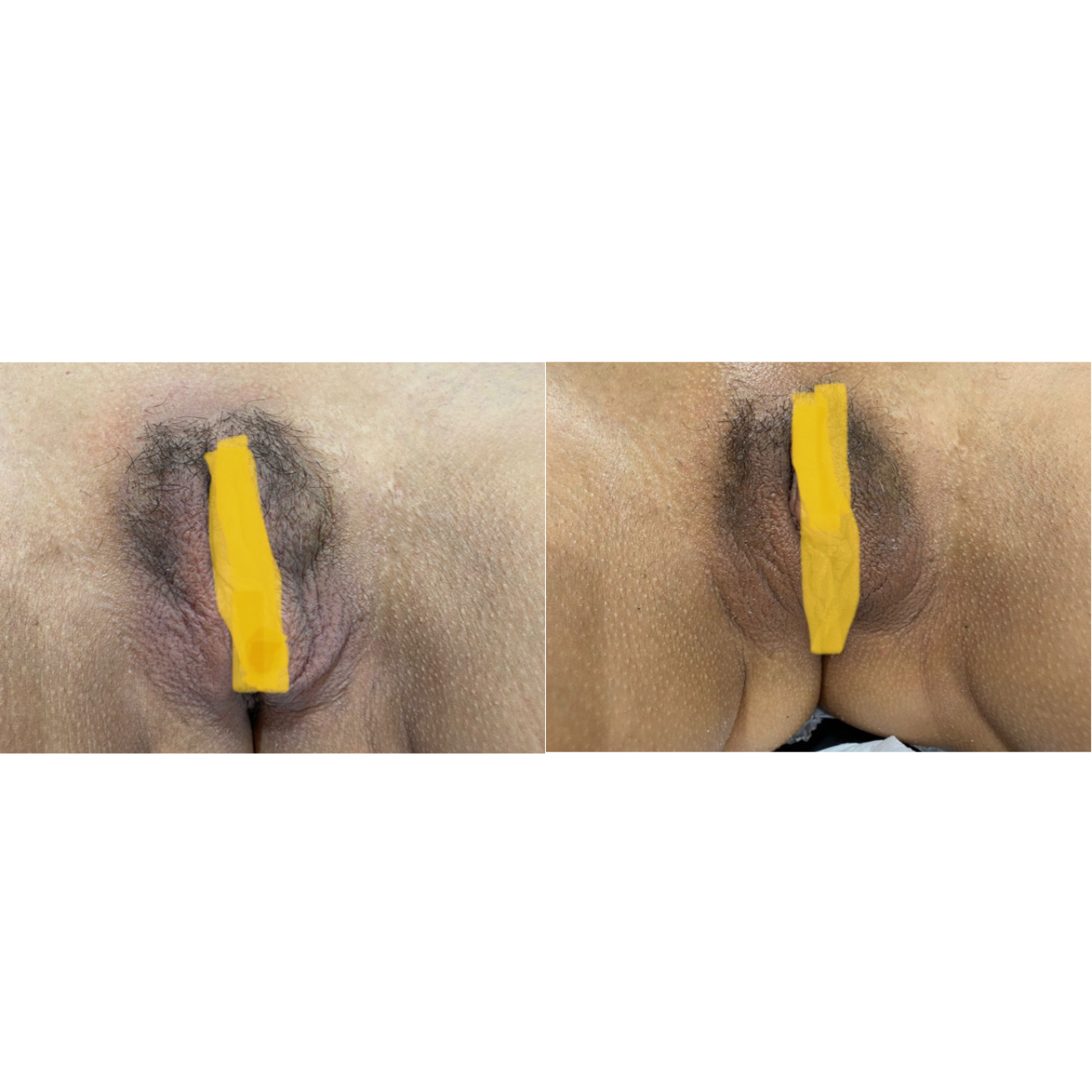 Resultado clínico 4