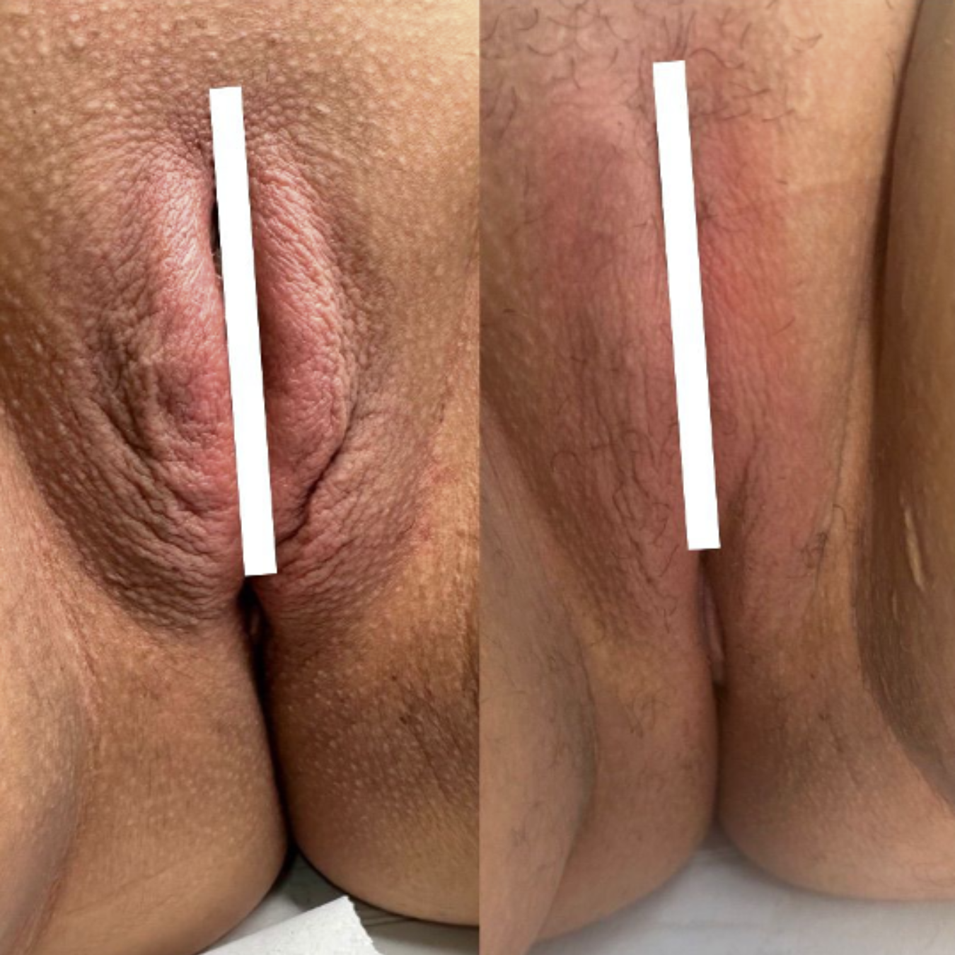 Resultado clínico 6