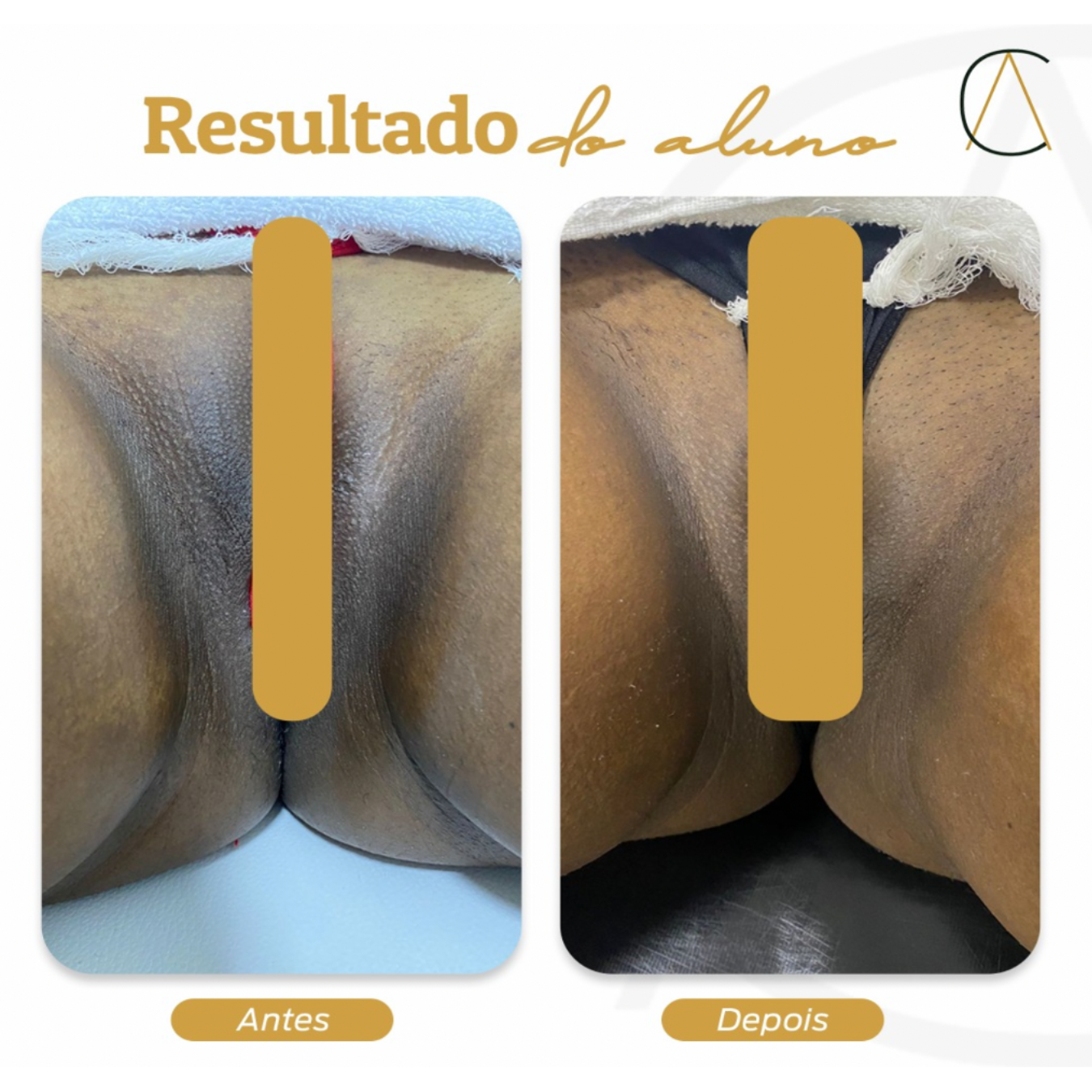 Resultado clínico 7