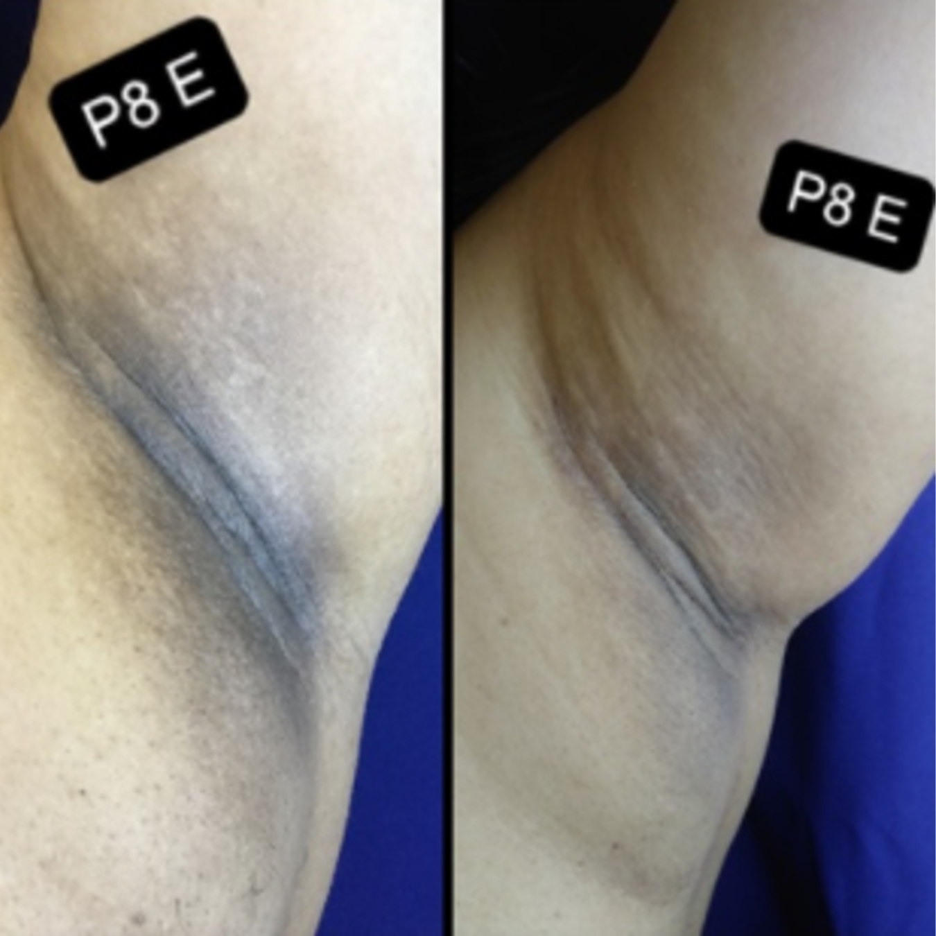 Resultado clínico 9